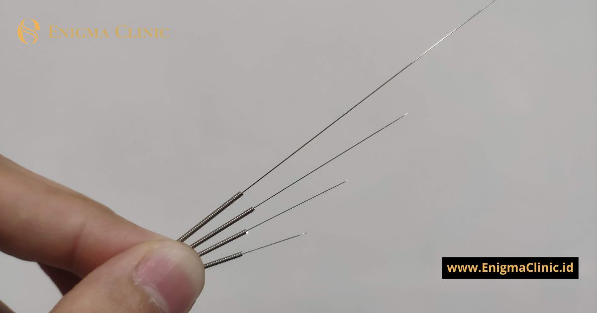 Enigma Clinic Hadir di Jakarta Selatan, Tawarkan terapi Akupunktur Medis